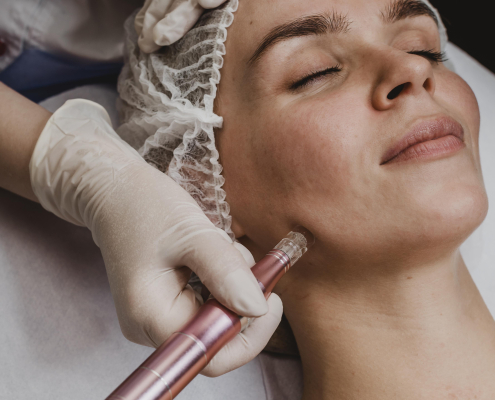 beautiful-woman-wellness-center-having-cosmetic-treatment Microneedling treatment